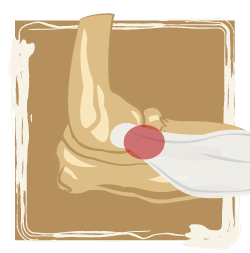 medical illustration of joint
