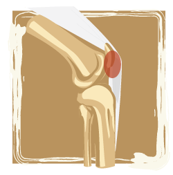 medical illustration of joint