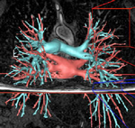 lung MRI