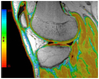 fellowship msk imaging musculoskeletal intervention radiology match re