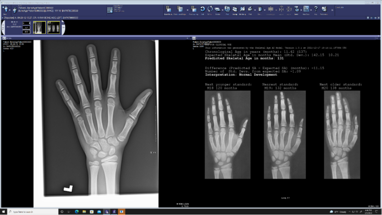 Rad Informatics Develops New AI Integration Automation in PACS ...