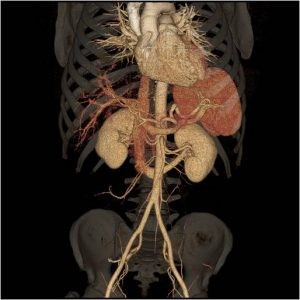 3D organ and vessel renderings of the abdomen and pelvis.